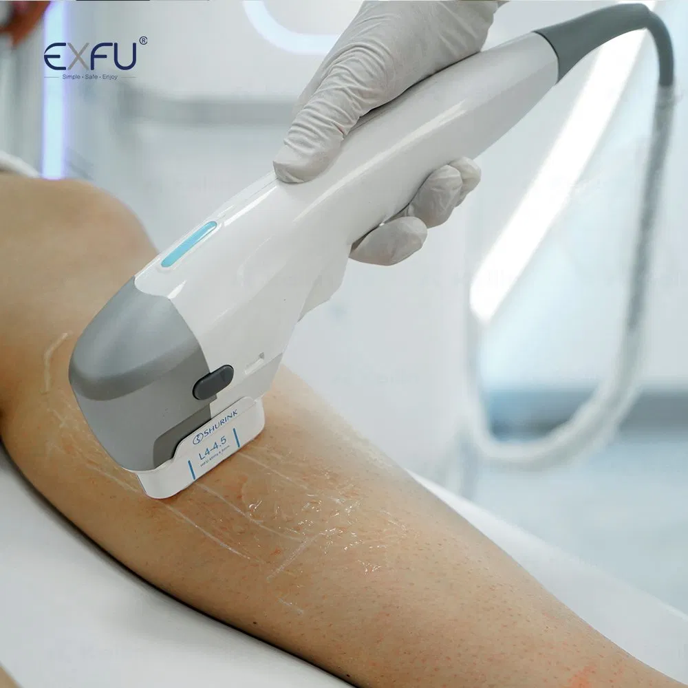 IPL+RF+ND YAG+Hifu+Gold Microneedles Diode Laser Tattoo Removal Laser 4in1 Medical Salon Beauty Equipment