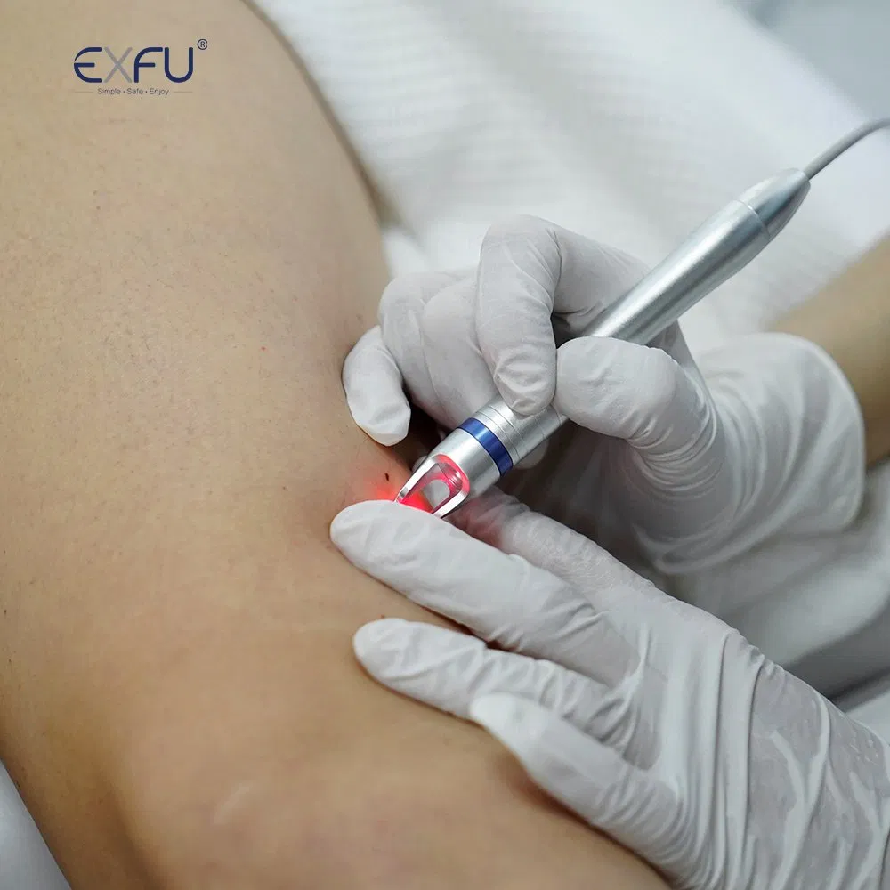 IPL+RF+ND YAG+Hifu+Gold Microneedles Diode Laser Tattoo Removal Laser 4in1 Medical Salon Beauty Equipment