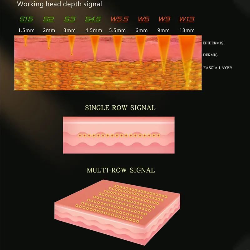 Portable Model 8d Hifu Face Machine Vmax Skin Tightening with 12 Lines