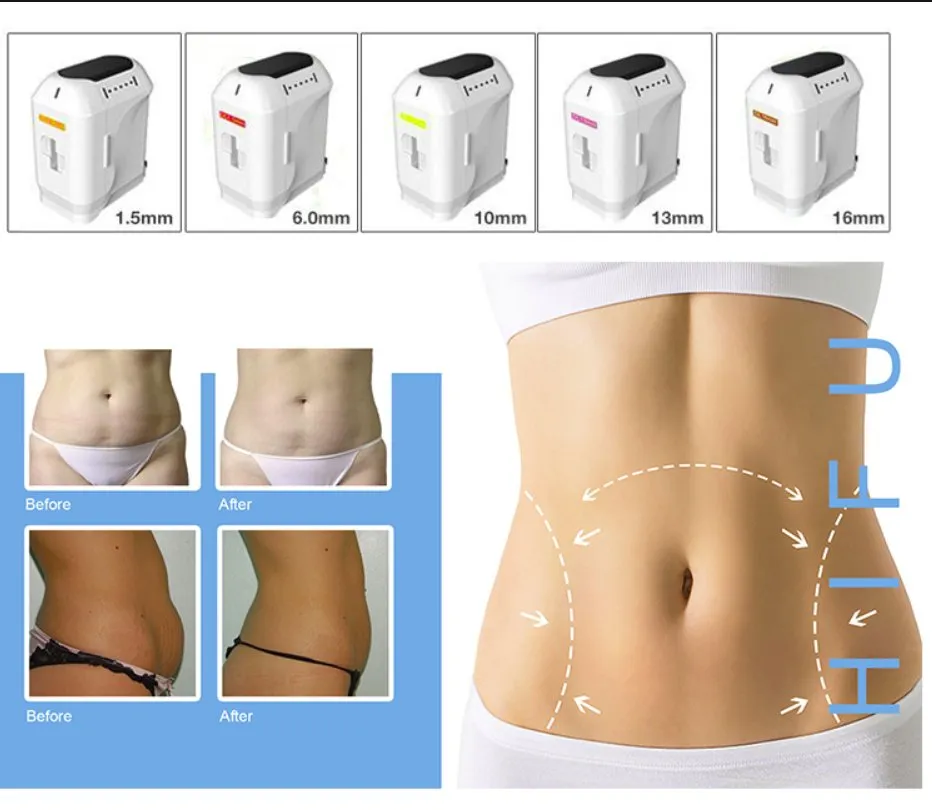 Portable Professional Hifu Device Face Lifting Skin Tightening Wrinkle Removal 7D Hifu