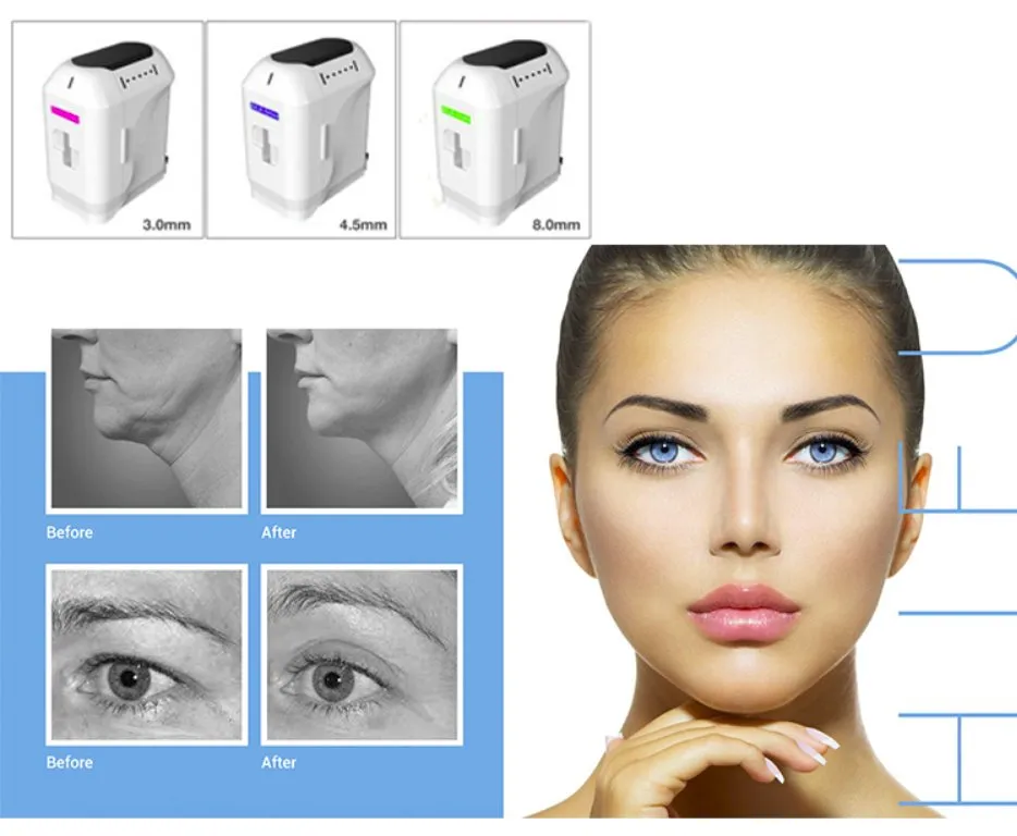Portable Professional Hifu Device Face Lifting Skin Tightening Wrinkle Removal 7D Hifu